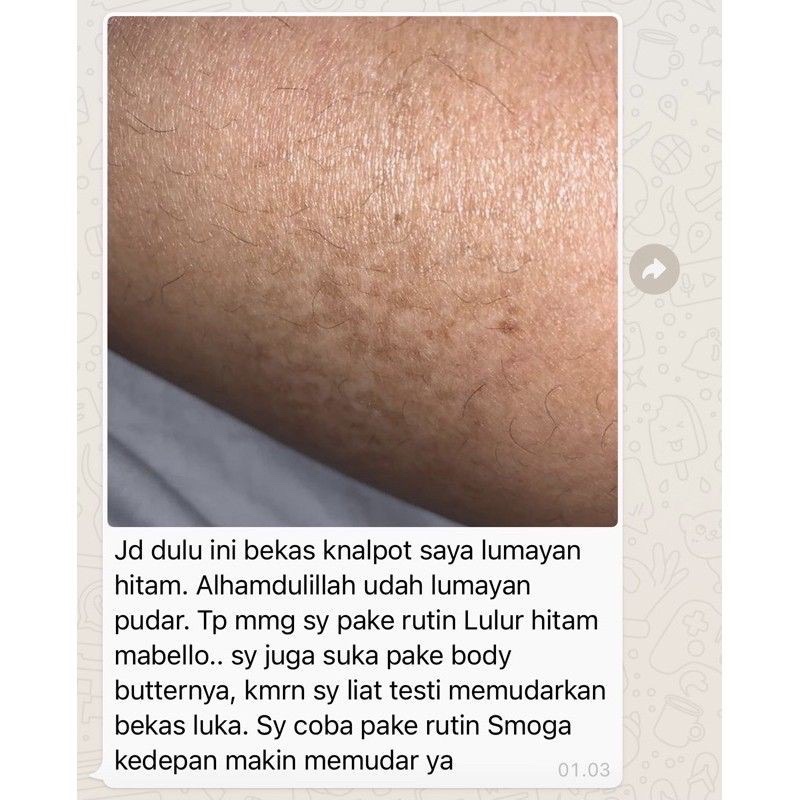 MABELLO BEDDA LOTONG LULUR HITAM BPOM &amp; HALAL MUI 1000% ORIGINAL