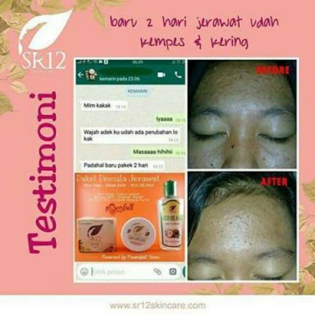 PAKET PEMULA SR12 KULIT BERMINYAK SENSITIF/NORMAL (KOMBINASI)