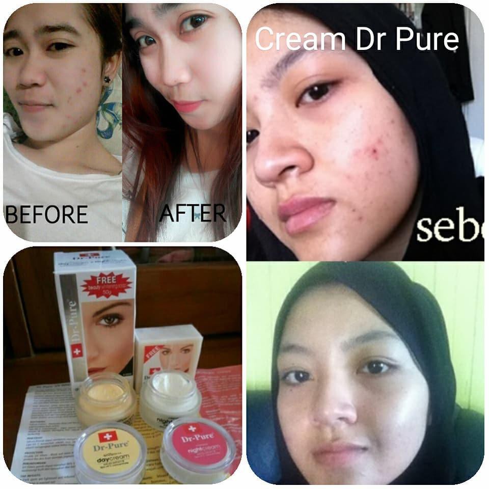 [Bayar Ditempat] DR PURE Cream Whitening Paket Krim Pemutih Siang dan Malam GRATIS Sabun muka