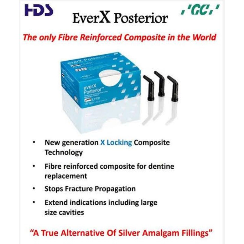 GC everX ever x ecer fiber posterior composite restoration tip tips komposit fiber