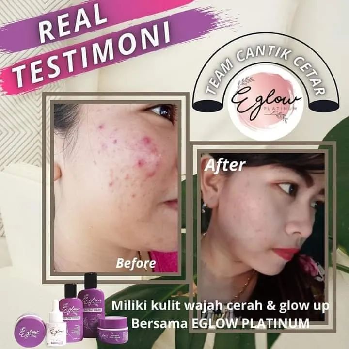 ( SALE JUAL CEPAT ) Eglow Skincare Original