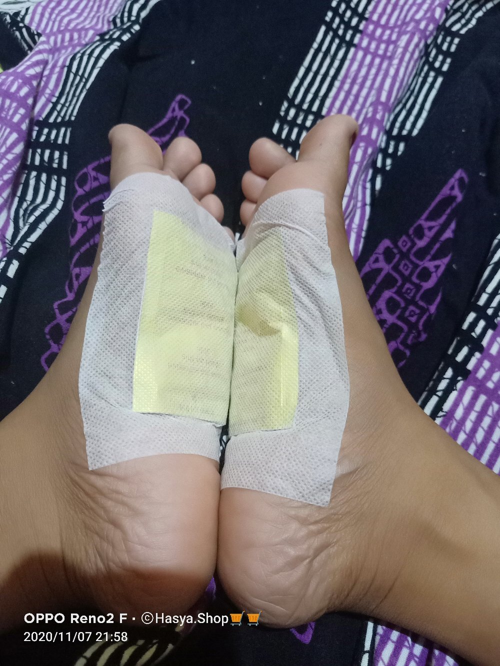 Kinoki Foot Pads Detox / Koyo Penyerap Racun