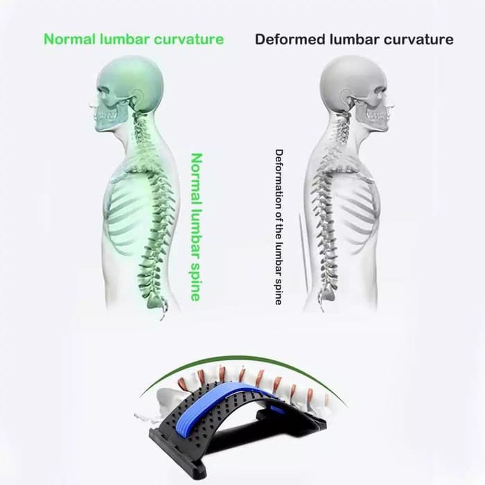 Back Stretcher Alat Terapi Pinggang Punggng Tulang Belakang Syaraf Kejepit