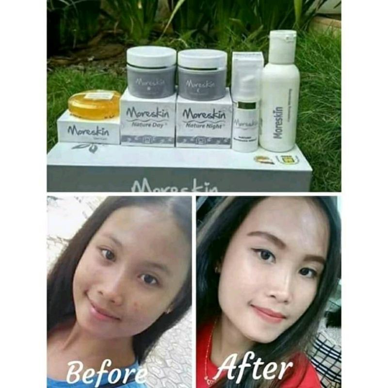 

moreskinnature