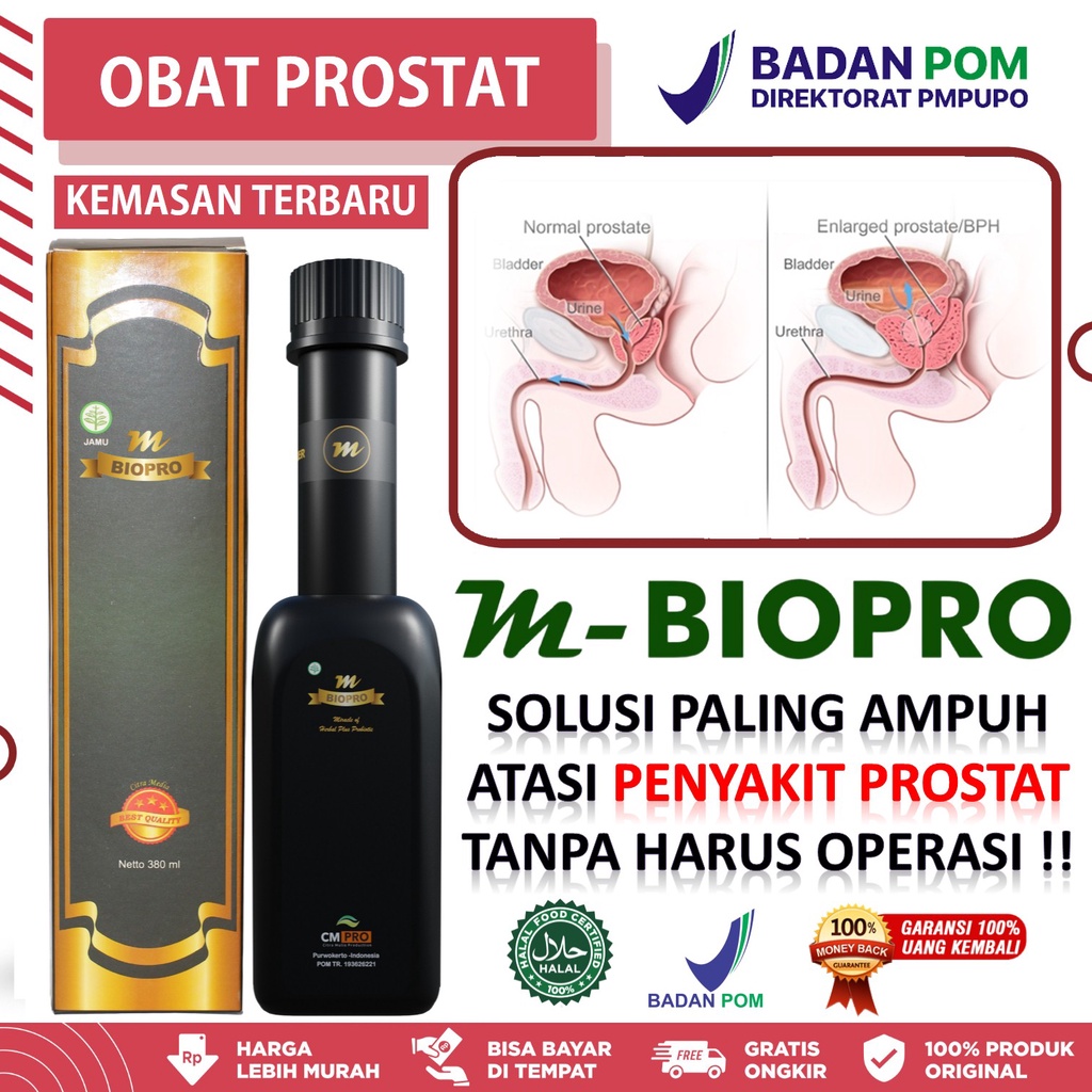 Obat Prostat Bengkak, Kanker Prostat, Infeksi Saluran Kemih, Susah Buang Air Kecil BAK, Kencing Peri
