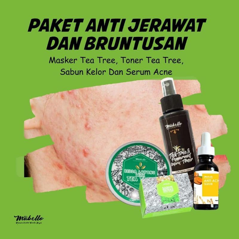 

mabellobaddalotong