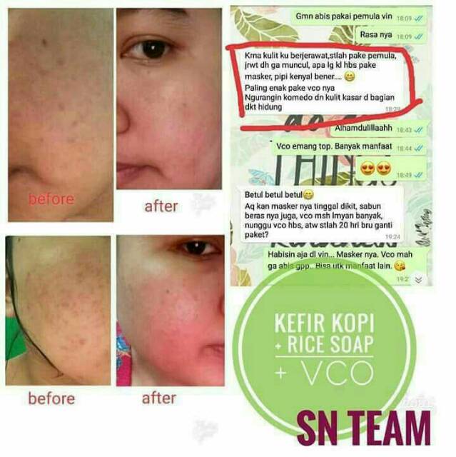 PAKET PEMULA SR12 Herbal Skncare BPOM Detoks Aman Mencerahkan Kulit Kinclong Bebas Jerawat Dan flek