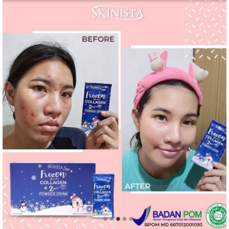 Powder drink frozen collagen by skinista BPOM dan HALAL
