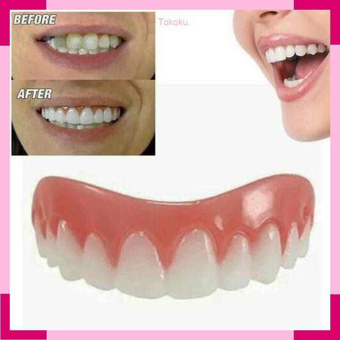 Gigi Palsu Instan Perfect Smile Veneer Gigi Tiruan Bagian Atas