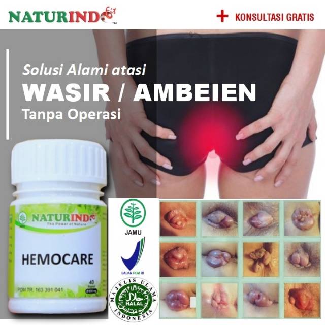 Obat Wasir Ambeien Stadium 1 Sampai 4 Hemoroid Ambeyen Herbal Alami Paling Ampuh Bab Berdarah Cod Shopee Indonesia