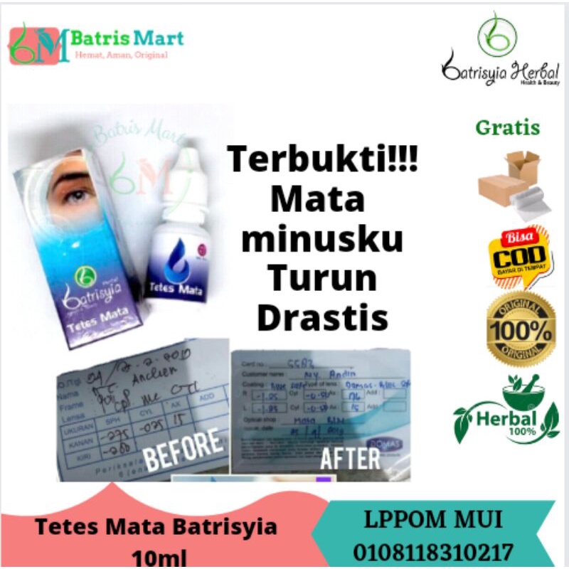 Obat tetes mata minus plus katarak batrisyia herbal 10ml