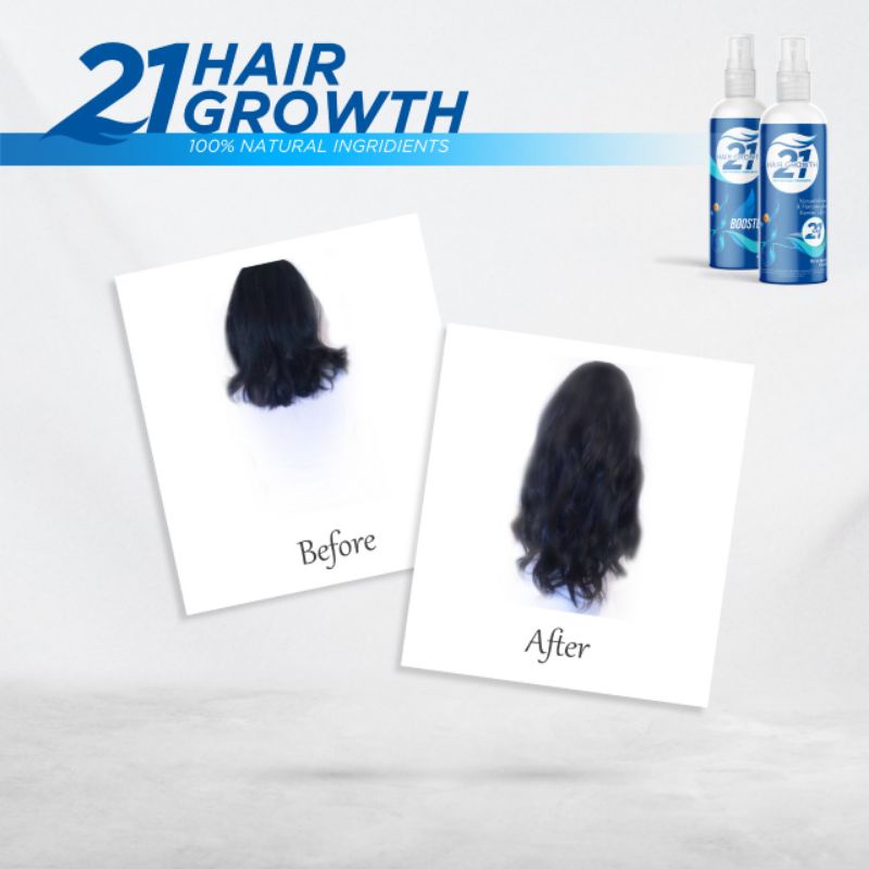 Serum Pemanjang &amp; Penumbuh Rambut tercepat No1 Di Indonesia, 2CM/5 Hari Perawatan Rambut Rontok Parah Pria Wanita anak