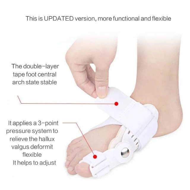 Bunion Orthopedic Alat Terapi Tulang Kaki