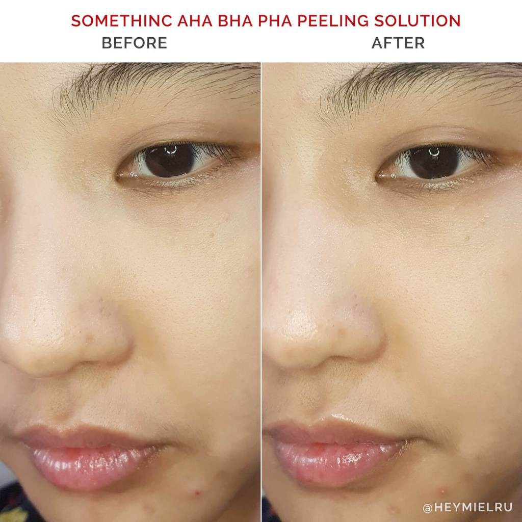 [NEW] SOMETHINC AHA BHA PHA Peeling Solution 20ml / Peeling