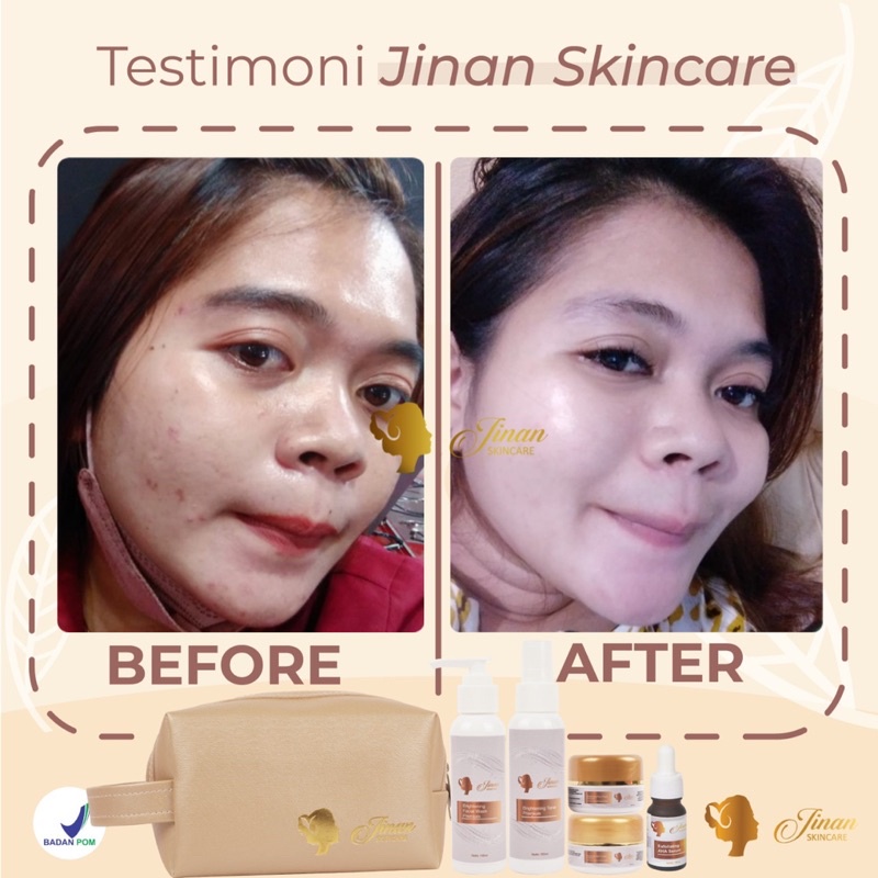 Jinan Whitening Skincare