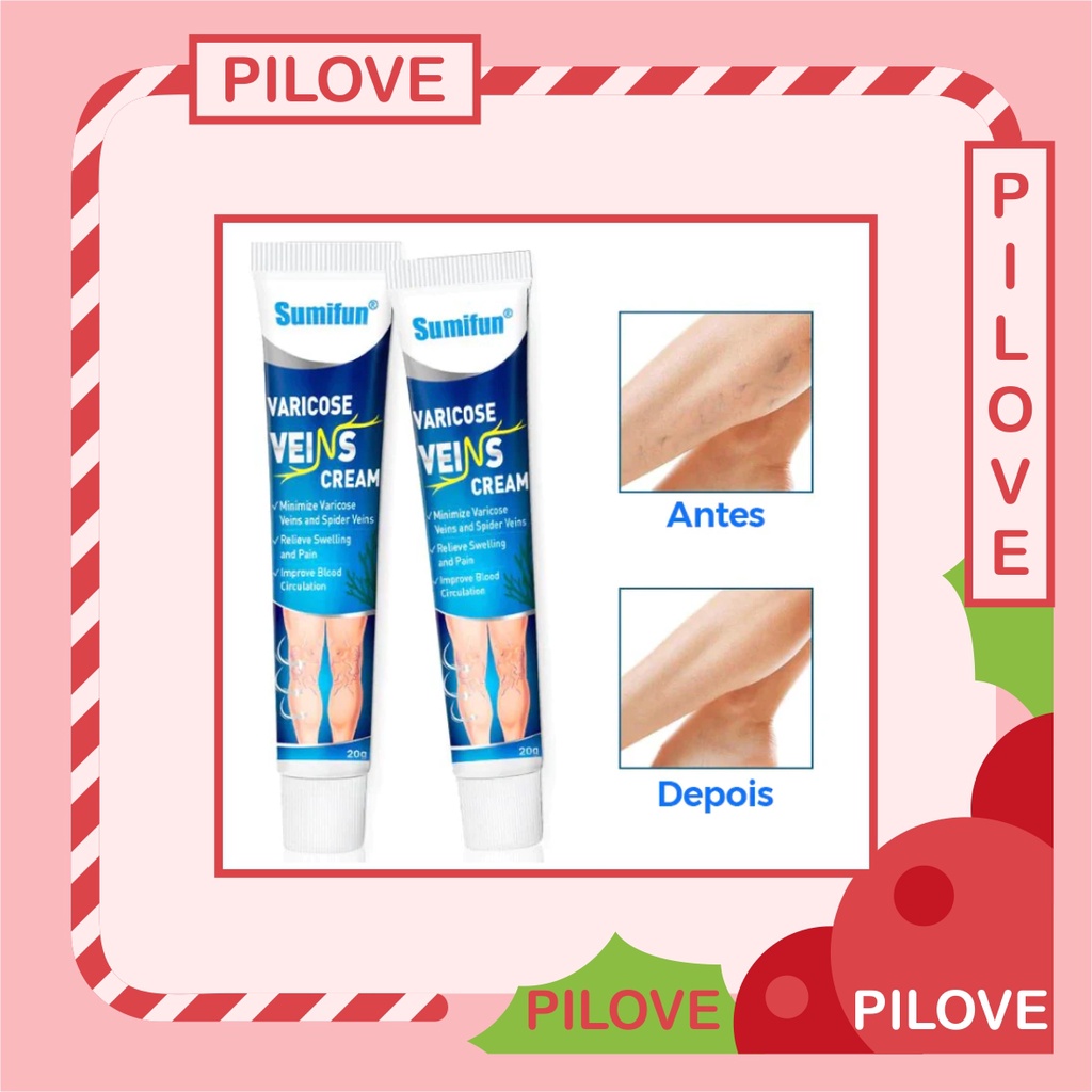 PILOVE - Salep Krim Cream Obat Penyembuh dan Penghilang Varises Parises Angitis Salep Flebitis di Kaki dan Betis Tangan Cream Krim Varises Hasil Paling Ampuh Original Hasil Permanen