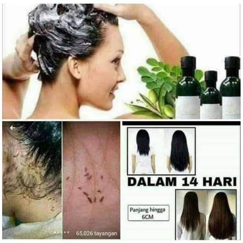 #ORLYN SHAMPOO NASA,PEMBASMI KUTU DAN UBAN
