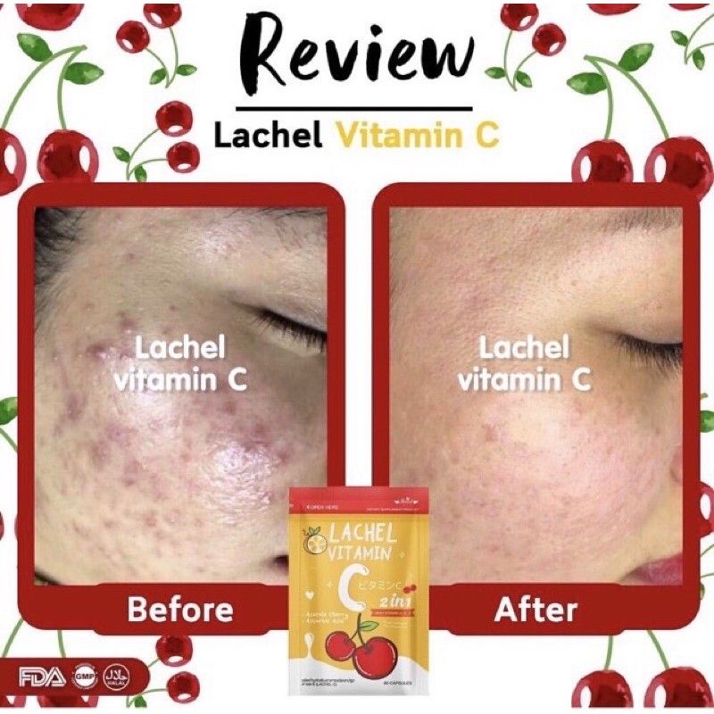 LACHEL VIT C / LACHEL VITAMIN C 100% ORIGINAL THAILAND