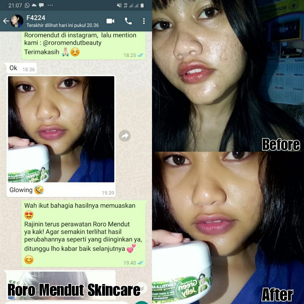 Roro Mendut Green Jelly Sleeping Mask Whitening + Anti Acne Jerawat 15 gr Super Glowing Premium