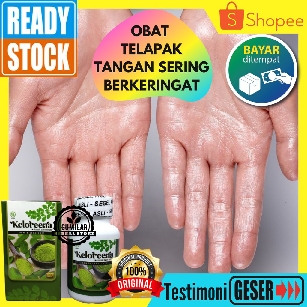 Jual Obat Telapak Tangan Bekeringat Kaki Berkeringat Berlebihan Telapak Tangan Basah Bpom 0422