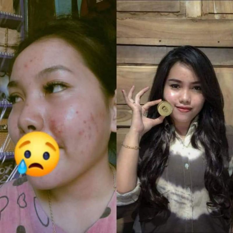 GOLD GELL WASILA COSMETIK kemasan baru10gr/skinbooster