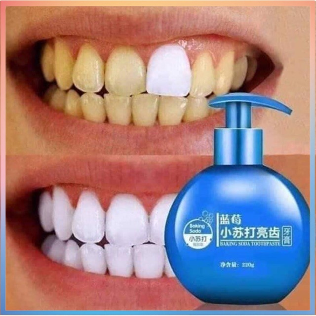 Odol Korea Pemutih Gigi - Baking Soda Tooth Paste - Viral