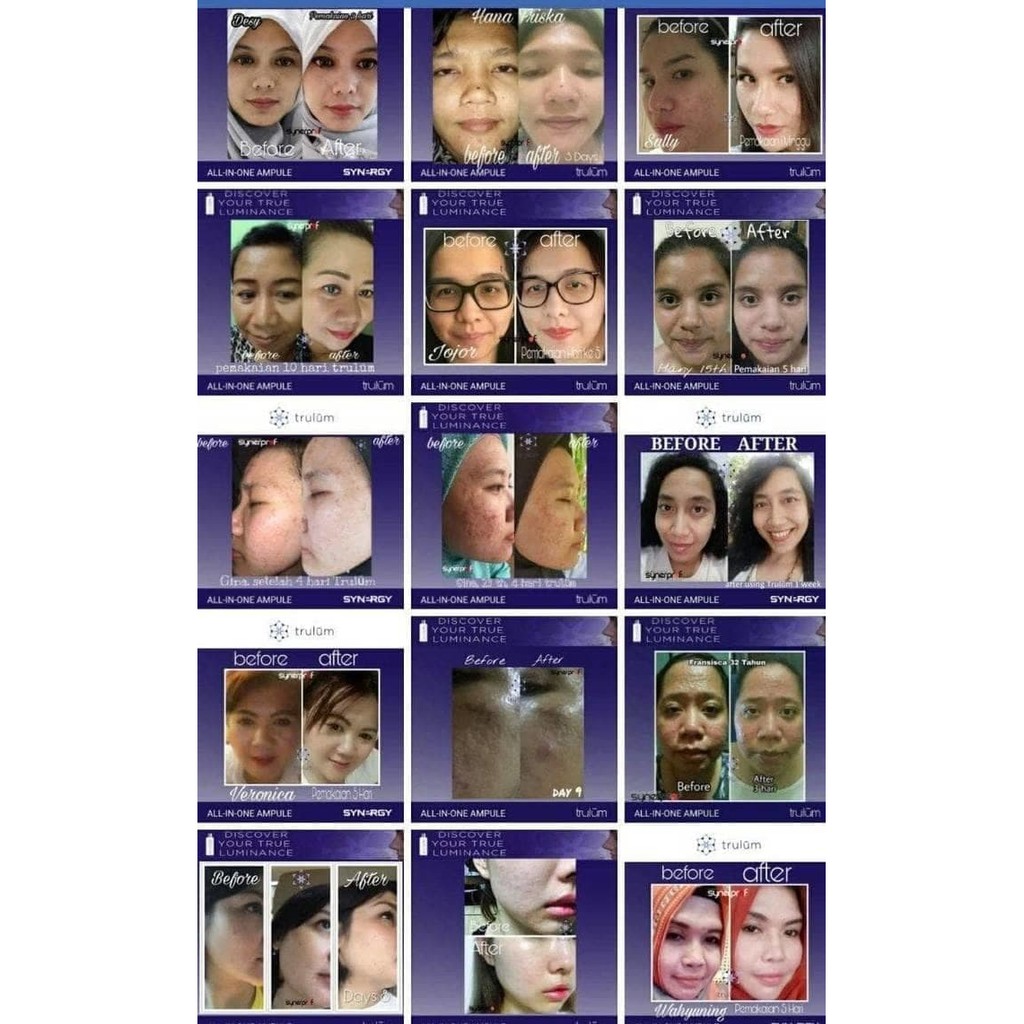 Krim Wajah Perawatan Trulum 5Ml/Atasi Kulit Kering Dan Keriput Murah Kecantikan OBGA6887