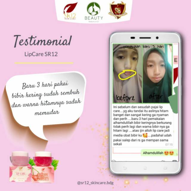 LIP CARE SR12 ORIGINAL BPOM