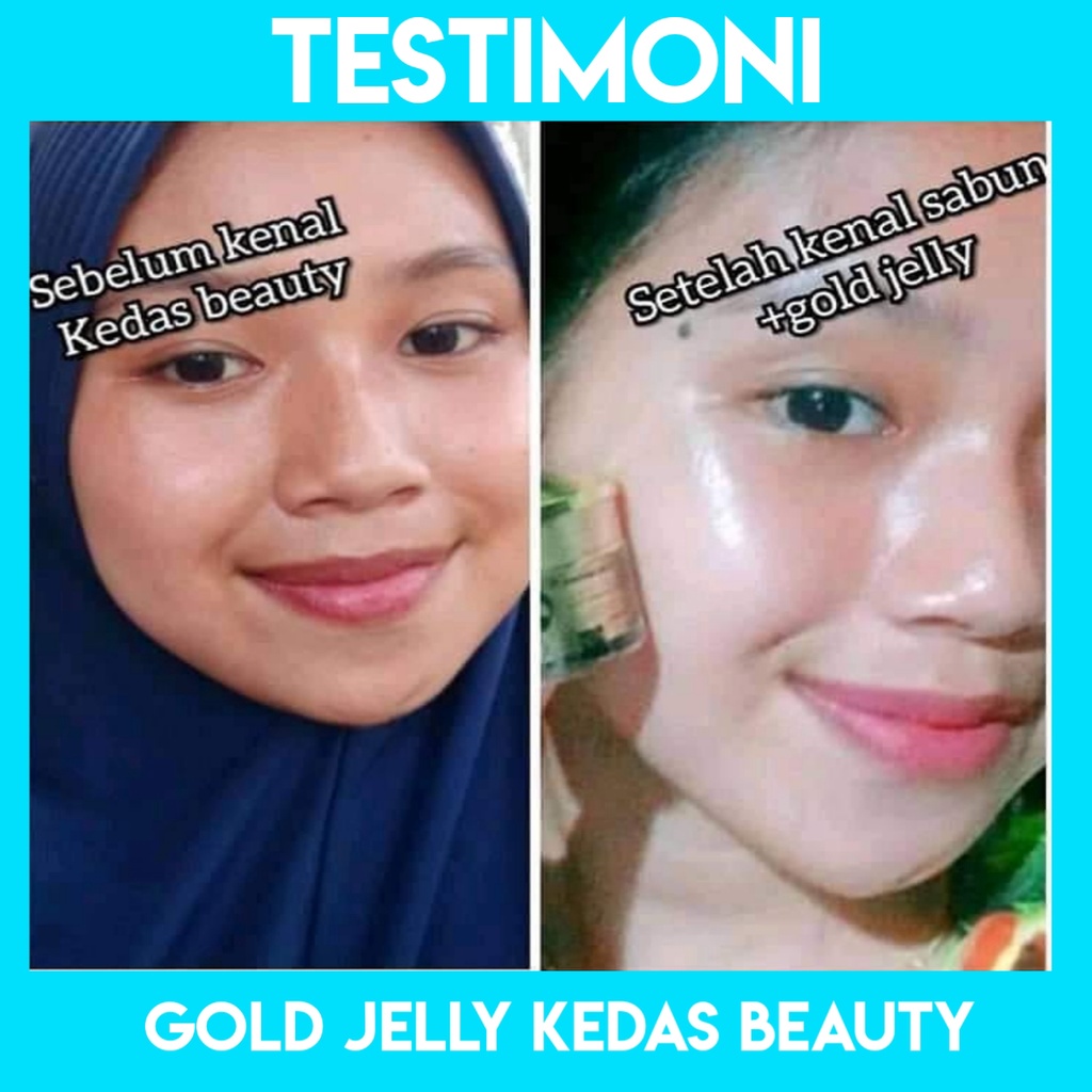 [ESTI KOSMETIK] GOLD JELLY KEDAS BEAUTY ORIGINAL BPOM CREAM WAJAH CREAM GLOWING CREAM PEMUTIH CREAM