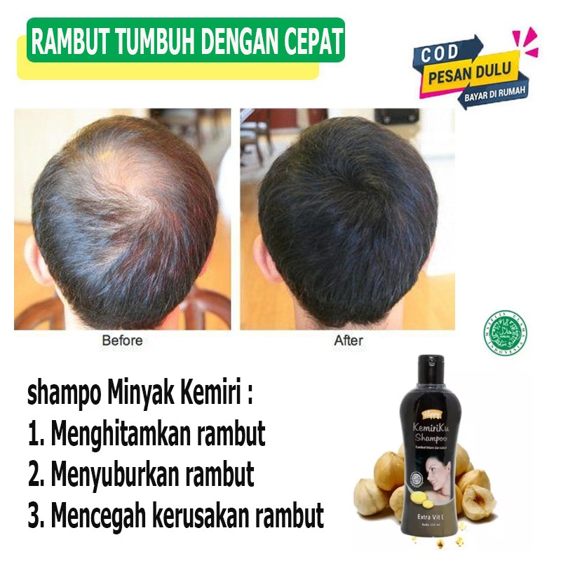 Harga Sampo Pemanjang Terbaik Perawatan Rambut Perawatan Kecantikan Mei 2021 Shopee Indonesia