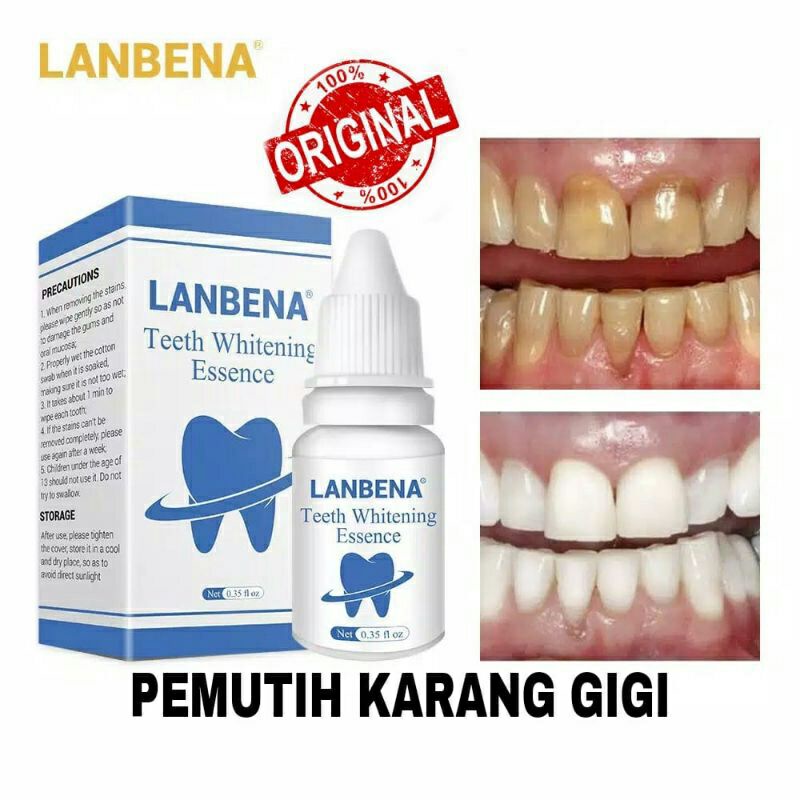 PEMUTIH GIGI PERMANEN LABENA TEETH WHITENING PENGHILANG KARANG GIGI