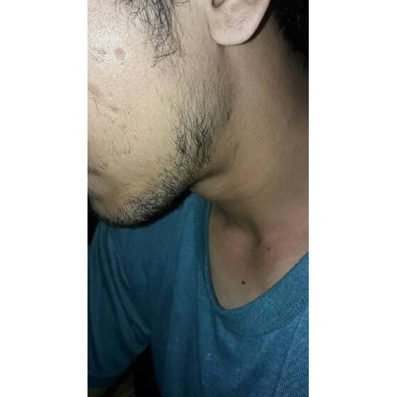 ♣ ZGTS DERMAROLLER 0.5 MM JARUM TITANIUM 192 PIN -ZGTS - DERMAROLLER ZGTS - PERAWTAN RAMBUT DAN BREW