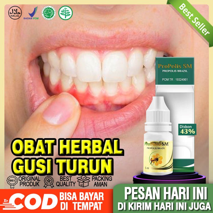Obat Gusi Turun Herbal, Obat Resesi Gusi, Gigi Turun - Propolis SM Brazil