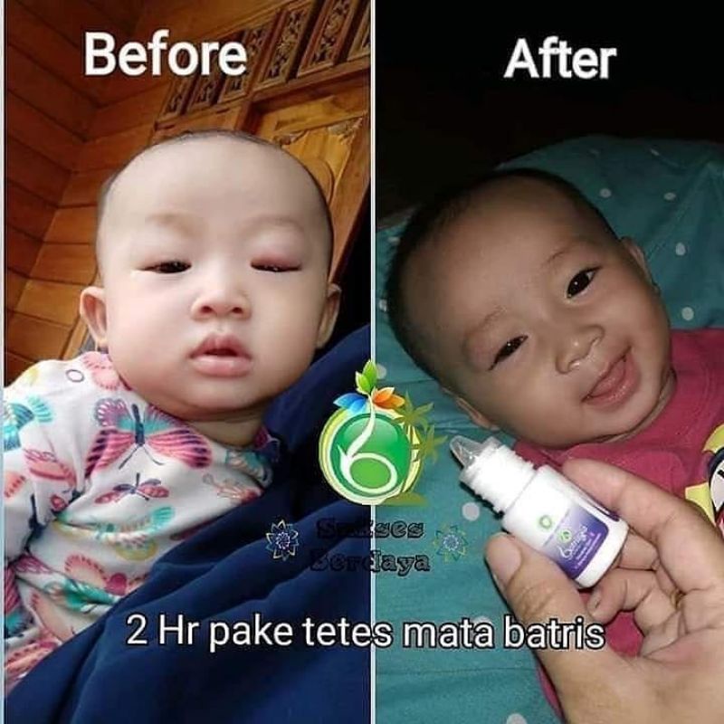 (BISA COD/ BAYAR DI TEMPAT) Obat tetes mata anak / obat tetes mata bayi/tetes mata anak bengkak merah berdarah bintitan belekan aman untuk bayi/ tetes mata iritasi anak