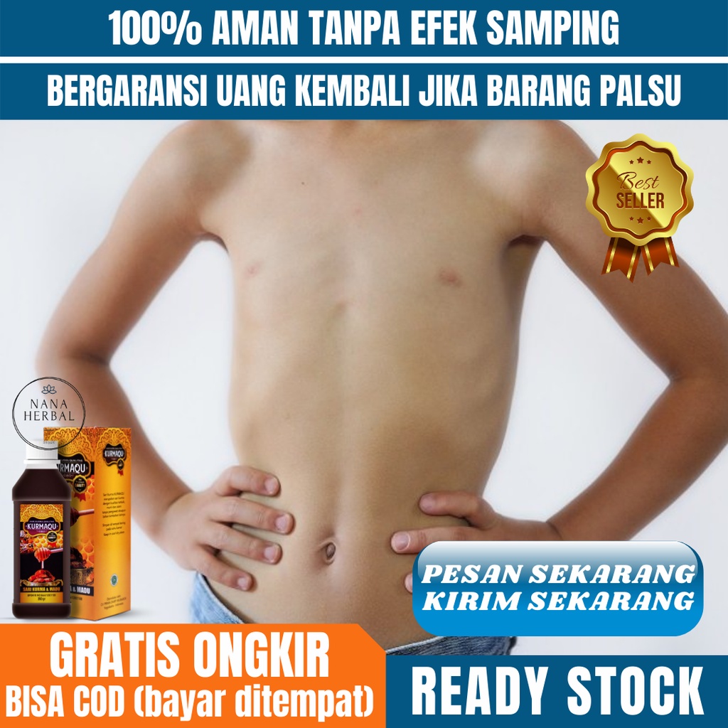 Nutrisi Penambah Gizi, Obat Kurang Gizi, Vitamin Penambah Gizi, Obat Gizi Buruk, Obat Malagizi, Asup