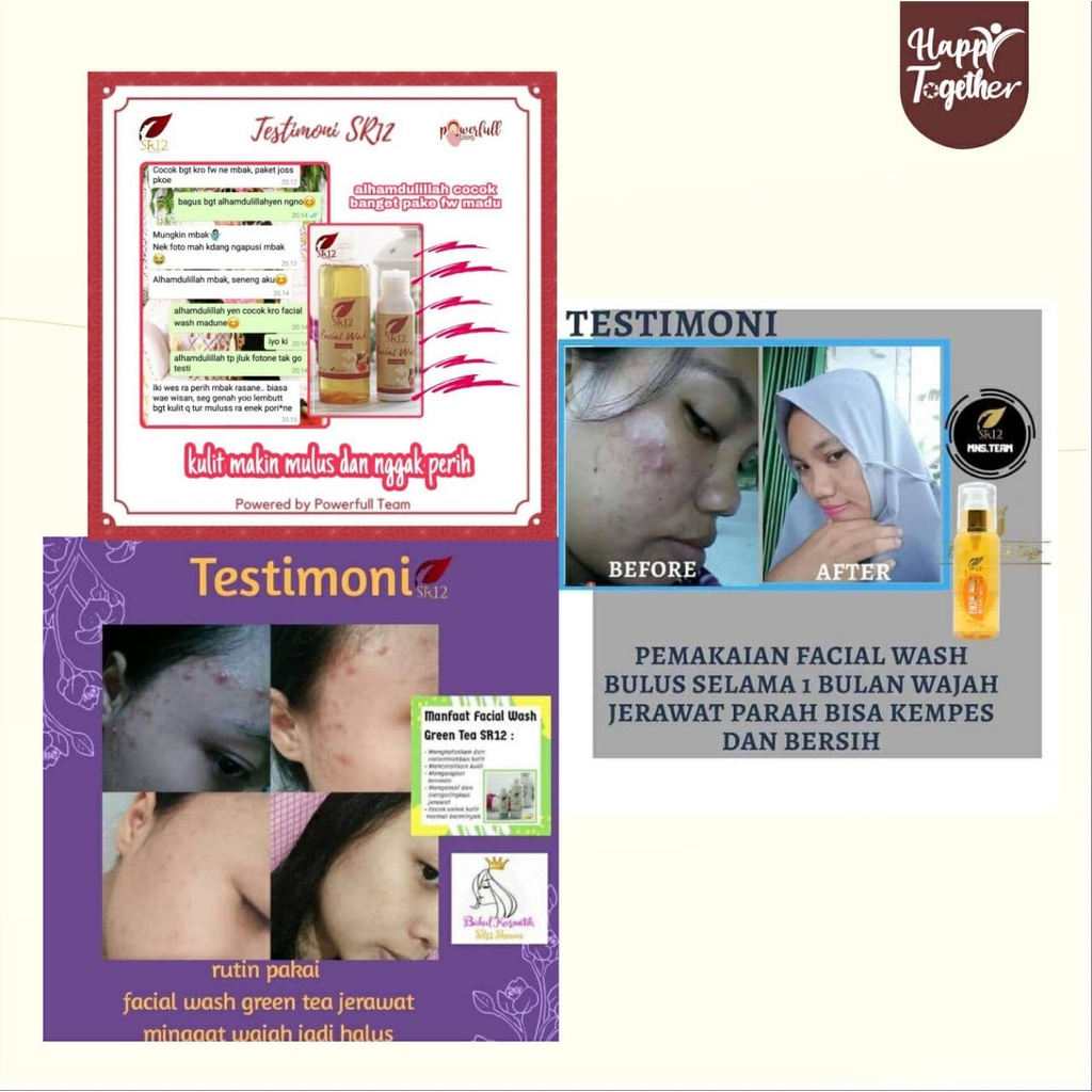 PAKET BOPENG KULIT BERMINYAK SR12 / SKINCARE PERAWATAN WAJAH /  / Paket perewatan wajah  original / premium / berkualitas / termurah / bagus / bpom / saudagarsr12