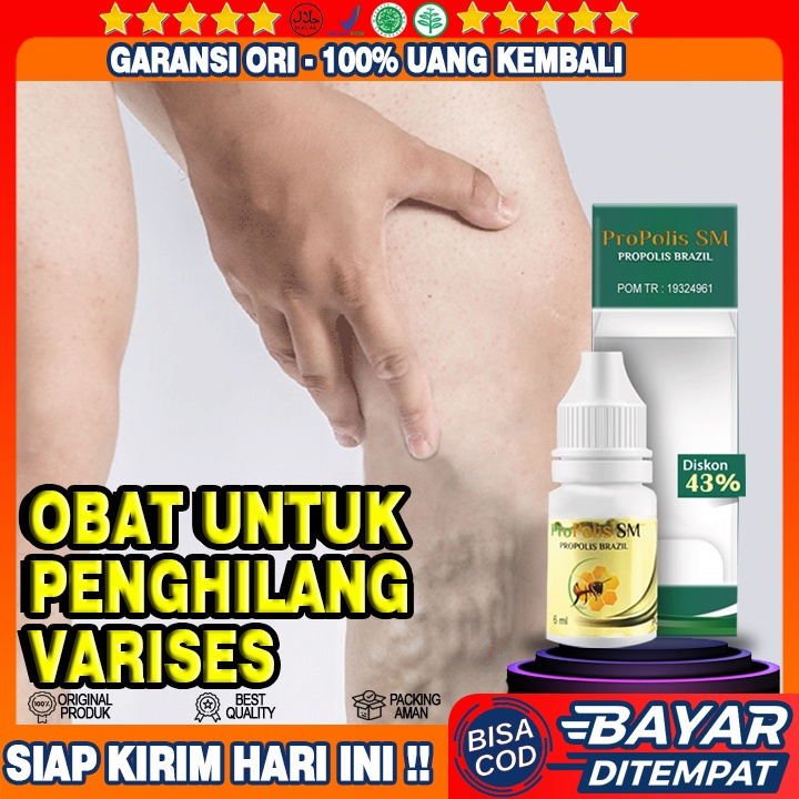 Obat Varises, Obat Varises Bekualitas Tinggi, Obat Varises