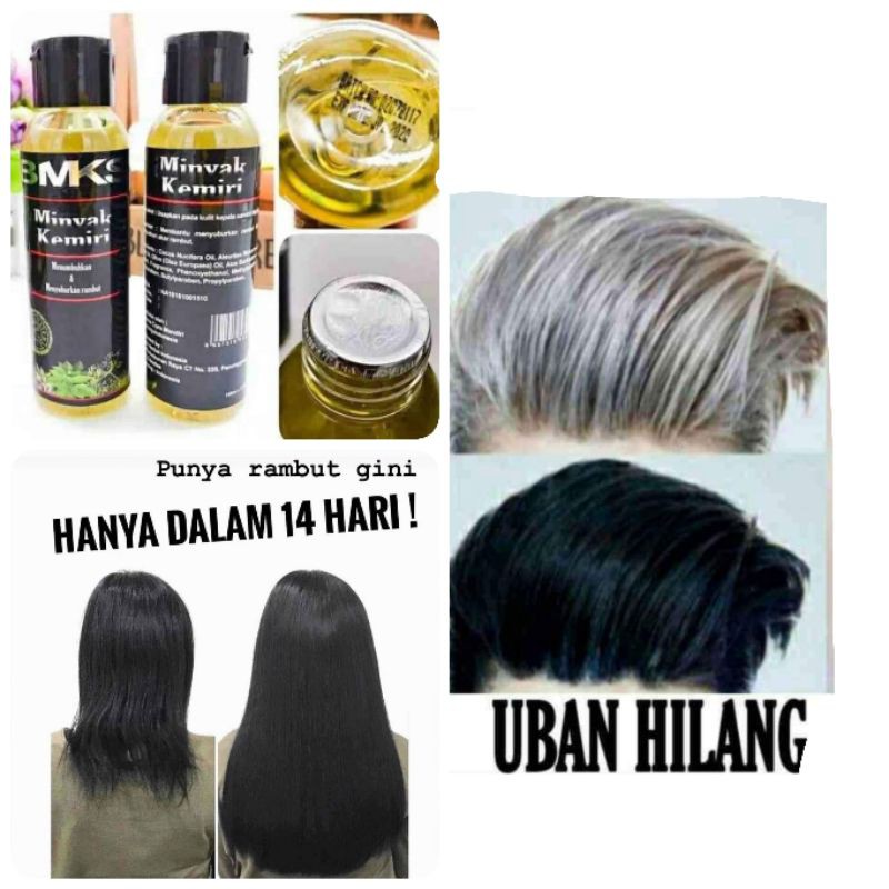 Jual Minyak Kemiri Minyak Penghitam Rambut Penghilang Rambut Bercabang Hair Treetment Oil Indonesia Shopee Indonesia