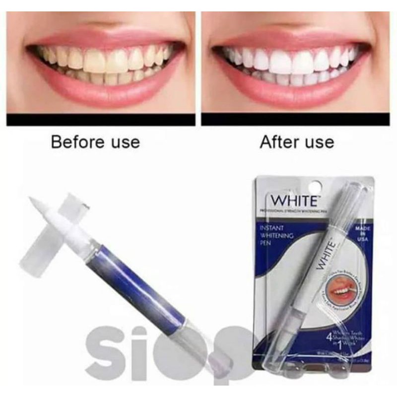 pemutih gigi permanen