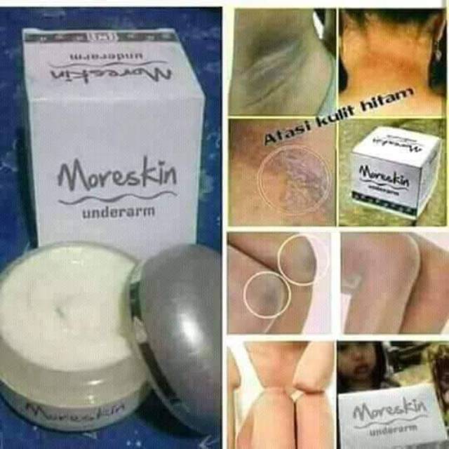 Moreskin underarrm nasa