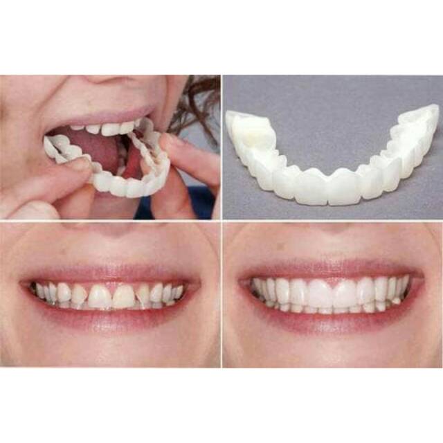 Snap on Smile