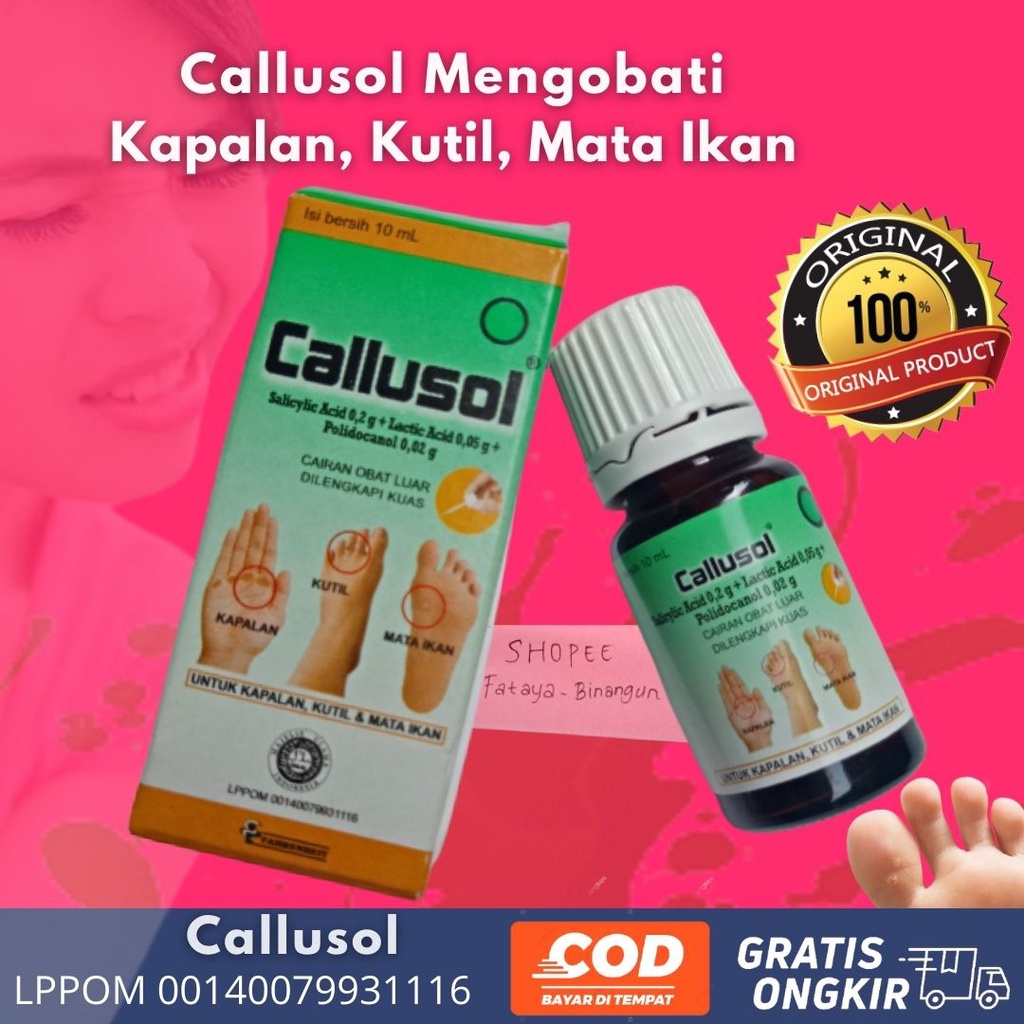 Callusol Obat Mata Ikan Kutil Kapalan Kalus Callus Calusol Salicylic Acid Mengobati Penyakit Kulit K