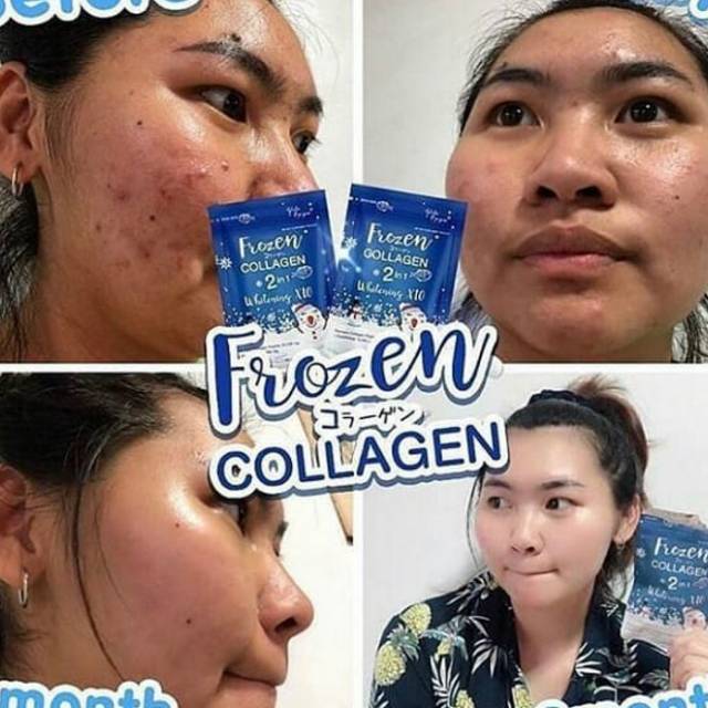 Frozen collagen Thailand