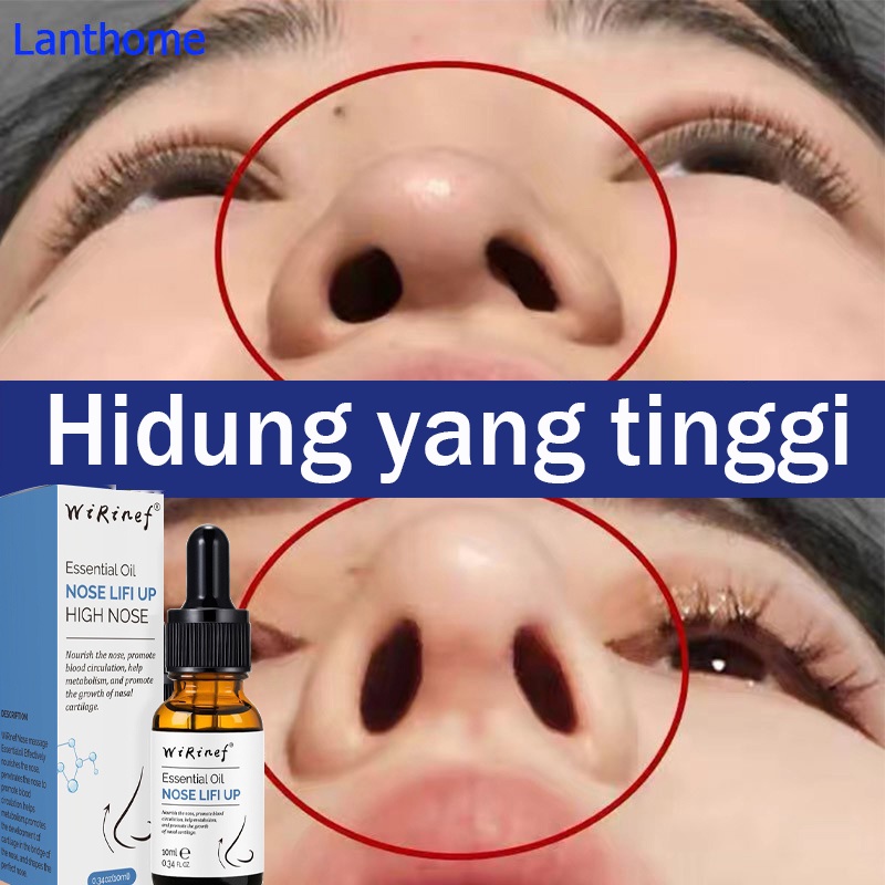 Minyak Pemancung Hidung Pemancung Hidung Esensi Pemancung Hidung 10g Minyak Tanaman Artefak Alami Yang Bantu Tumbuh Cepat Krim Pemancung Hidung