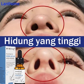 Image of thu nhỏ Minyak Pemancung Hidung Pemancung Hidung Esensi Pemancung Hidung 10g Minyak Tanaman Artefak Alami Yang Bantu Tumbuh Cepat Krim Pemancung Hidung #4