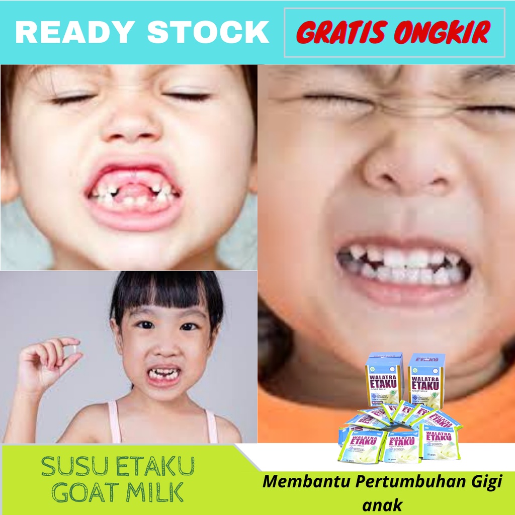 

Etaku Goat Milk Asli, Etaku Asli Susu Kambing Goat Milk, Untuk Obat Suplemen Tulang , Penguat Tulang Alami , Susu Nutrisi Pertumbuhan Tulang dari Dalam, Etaku Susu Kambing Etawa Asli 100%, Susu untuk pertumbuhan gigi anak