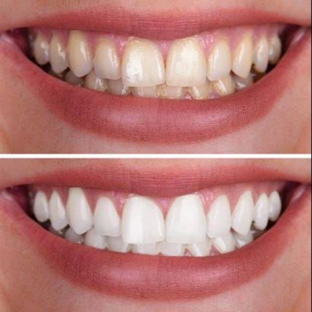 

Herbal toothpastetr
