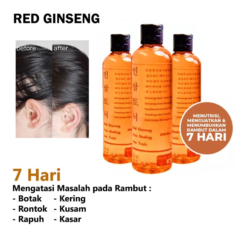 ( Original 100% ) Red Ginseng Hair Tonic Mengatasi Rambut Rontok Parah Vitamin Melangsang dan Menguatkan Akar Rambut