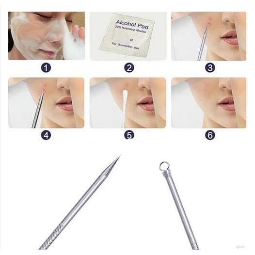 Stainless steel Blackhead Removal Tool Set (5pcs)