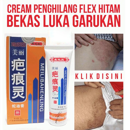 Krim Penghilang Bekas Luka Cream Luka Penyembuh Kena Air Panas Kena Knalpot Meilibahenling Cream Ori Shopee Indonesia